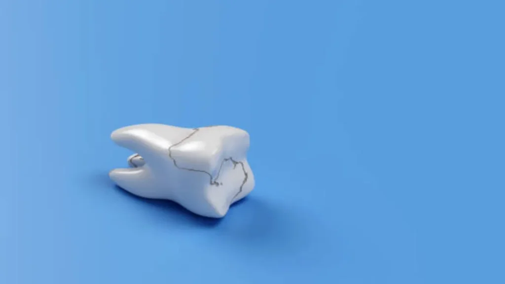 how to fix a cracked tooth naturally the right way